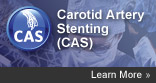 Carotid Artery Stenting (CAS)